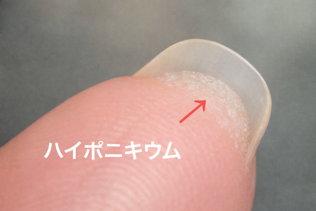 ハイポニキウム