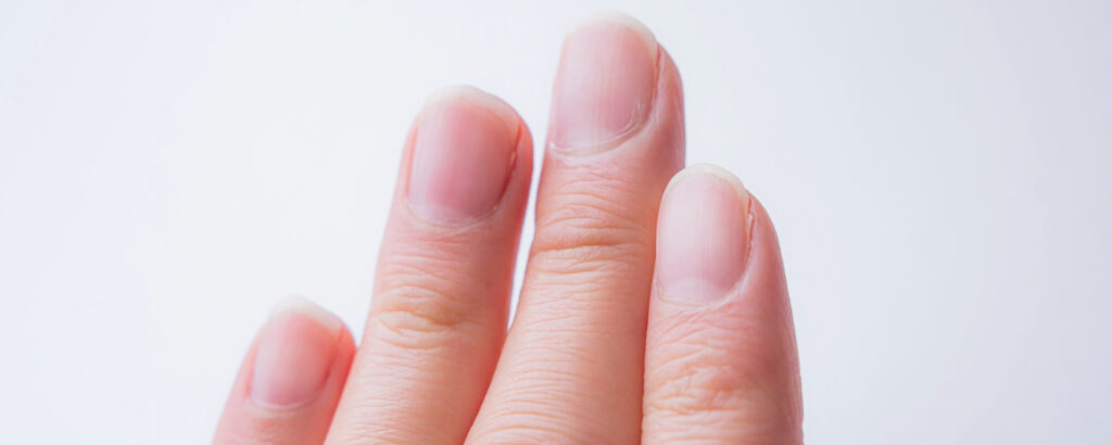 【結論】自分で綺麗じゃないと思うなら“絶対にやるべき”