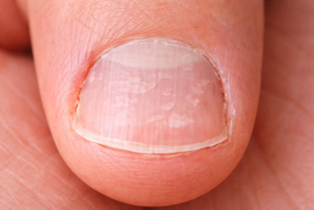 爪表面が凸凹のイメージ