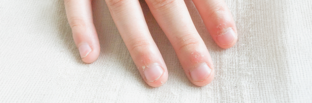 見出し画像③：【具体例】そもそも「やるべき人」はどんな爪？